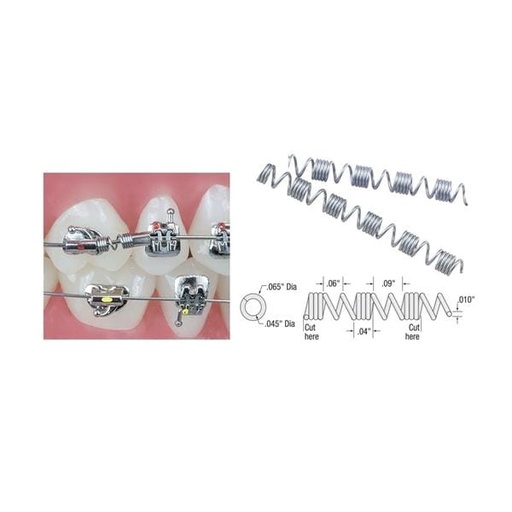 TruFlex Distalizing Spring Nickel Titanium 7 in 0.010 in x 0.045 in 3/Pk